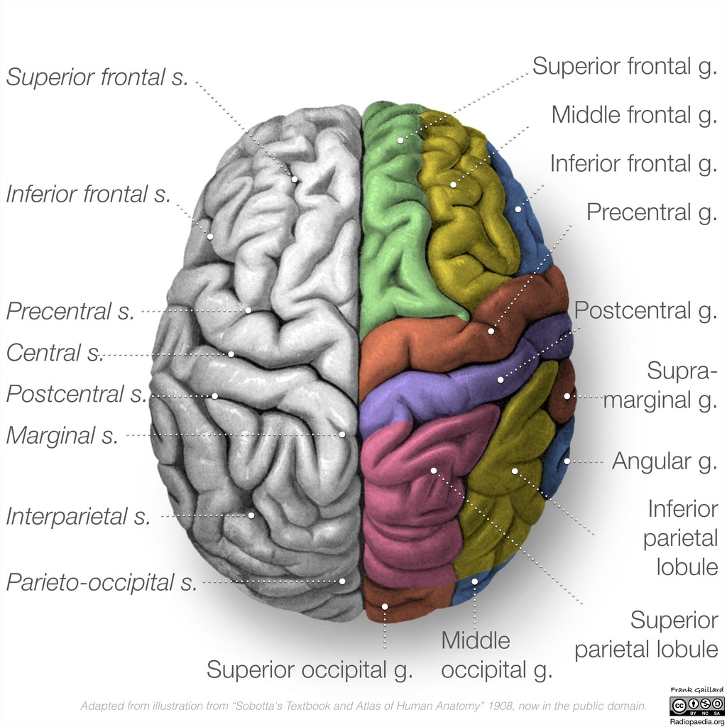 Radiopaedia Drawing Gyri And Sulci Superior Surface Of Brain